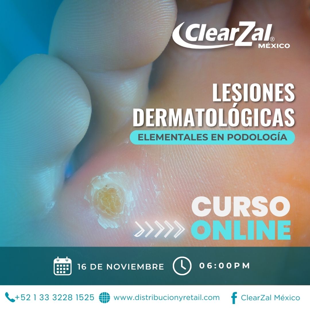 Curso Lesiones Dermatológicas Elementales en Podología