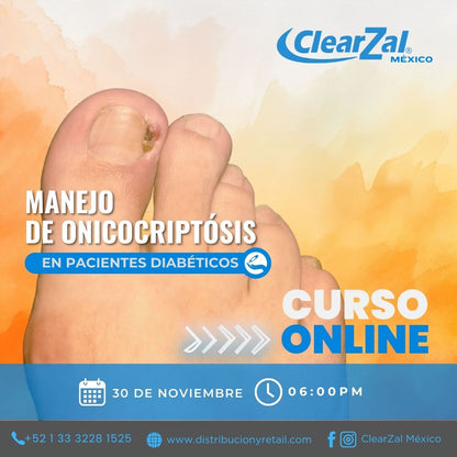 Curso Manejo de la Onicocriptósis en Pacientes Diabéticos