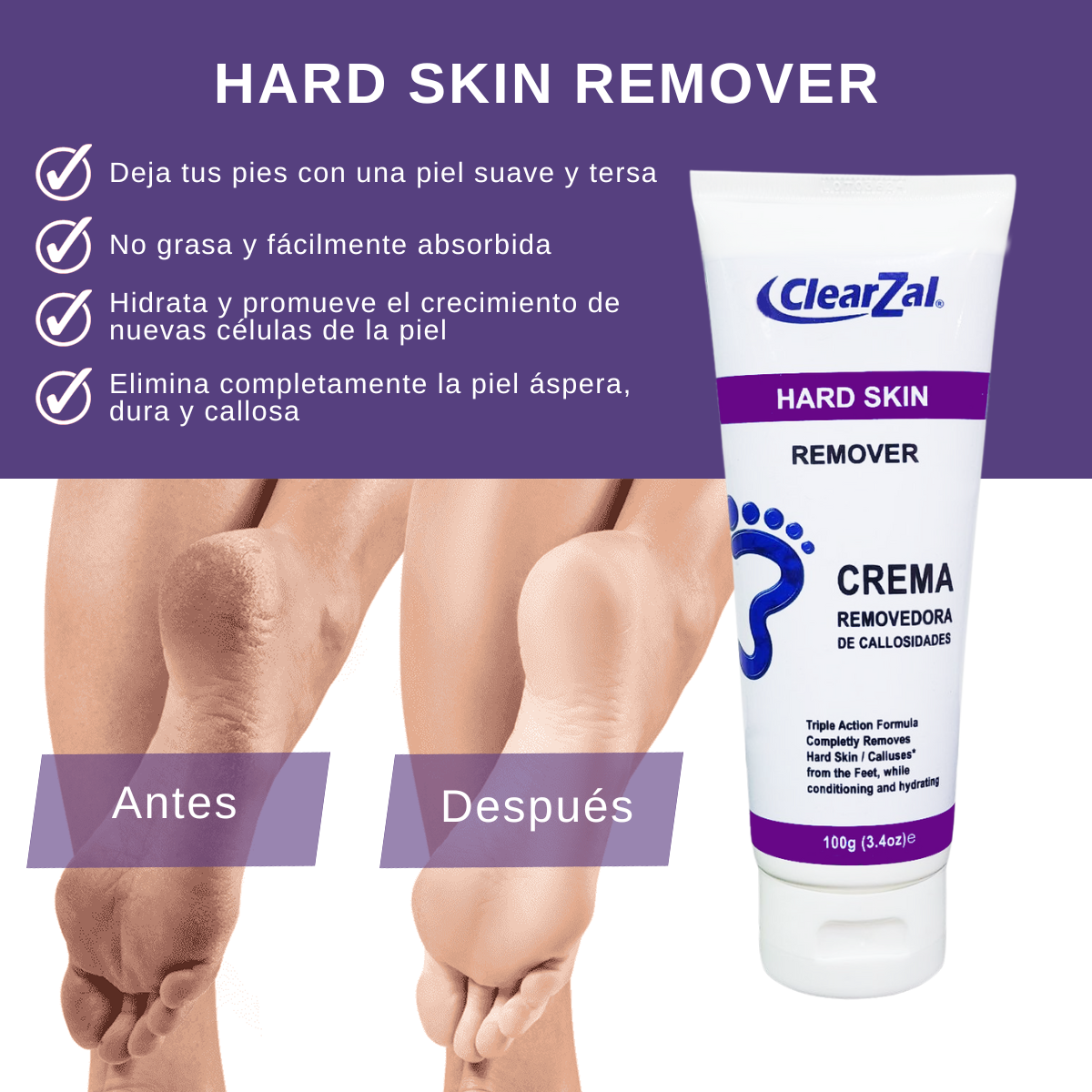 ClearZal Hard Skin Remover