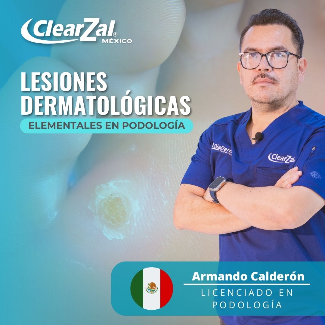 Curso Lesiones Dermatológicas Elementales en Podología